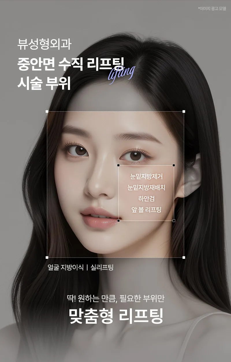 뷰성형외과 ❤뷰❤중안면 수직 리프팅 이벤트, 시술 상세 이미지