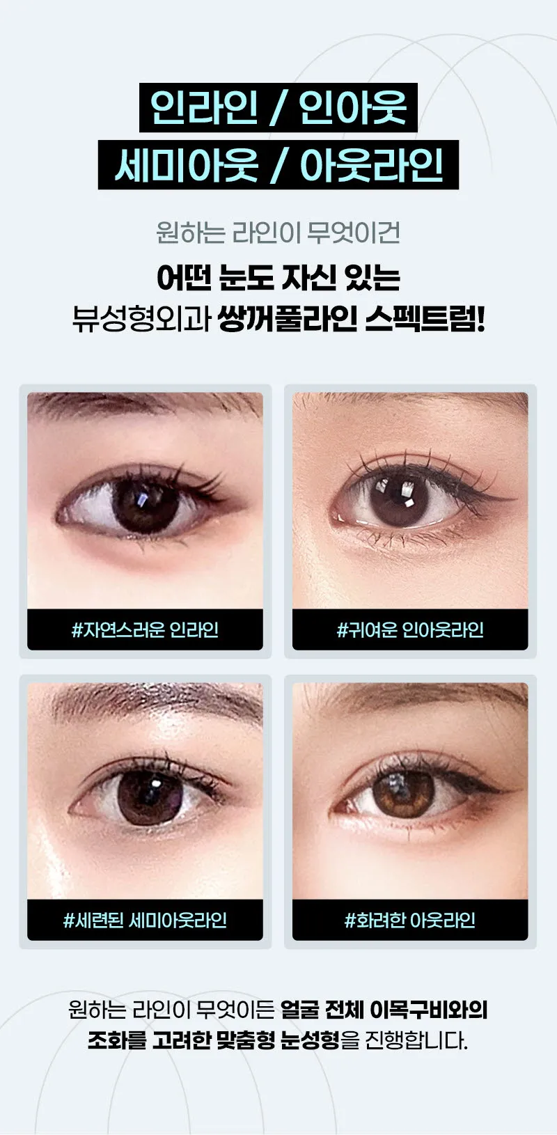 뷰성형외과 ❤️뷰❤️눈성형 이벤트, 시술 상세 이미지