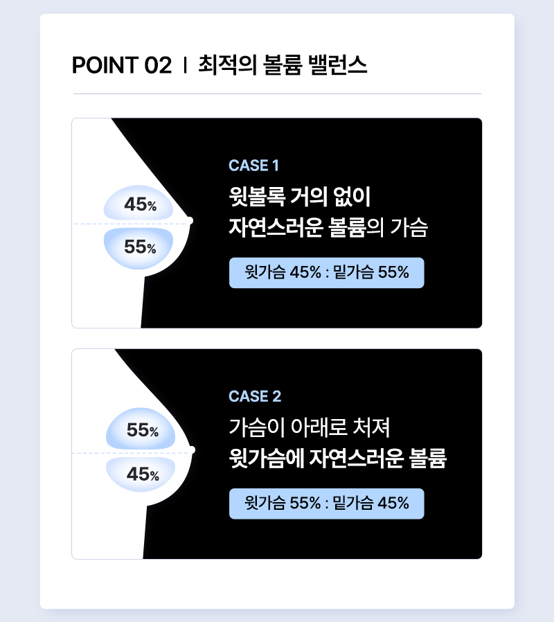 뷰성형외과 ❤️뷰❤️UIU 멘토 엑스트라 이벤트, 시술 상세 이미지