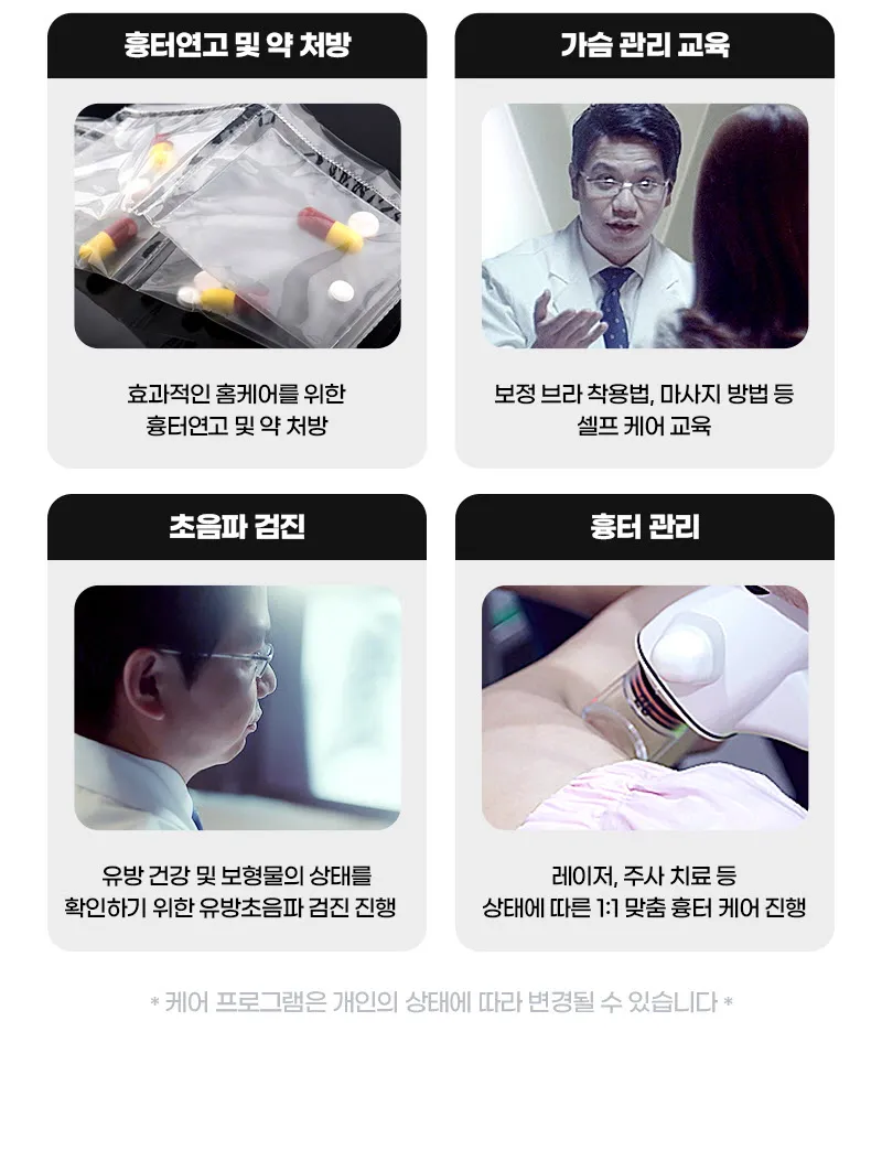 뷰성형외과 ❤️뷰❤️ 모티바 가슴성형 이벤트, 시술 상세 이미지