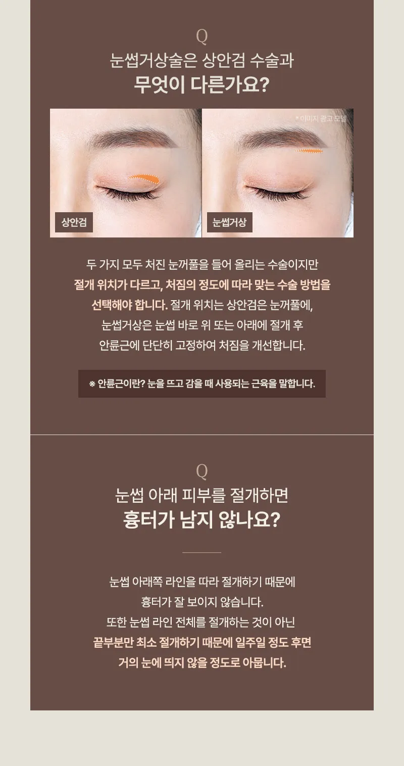 ❤️뷰❤️중년 눈성형