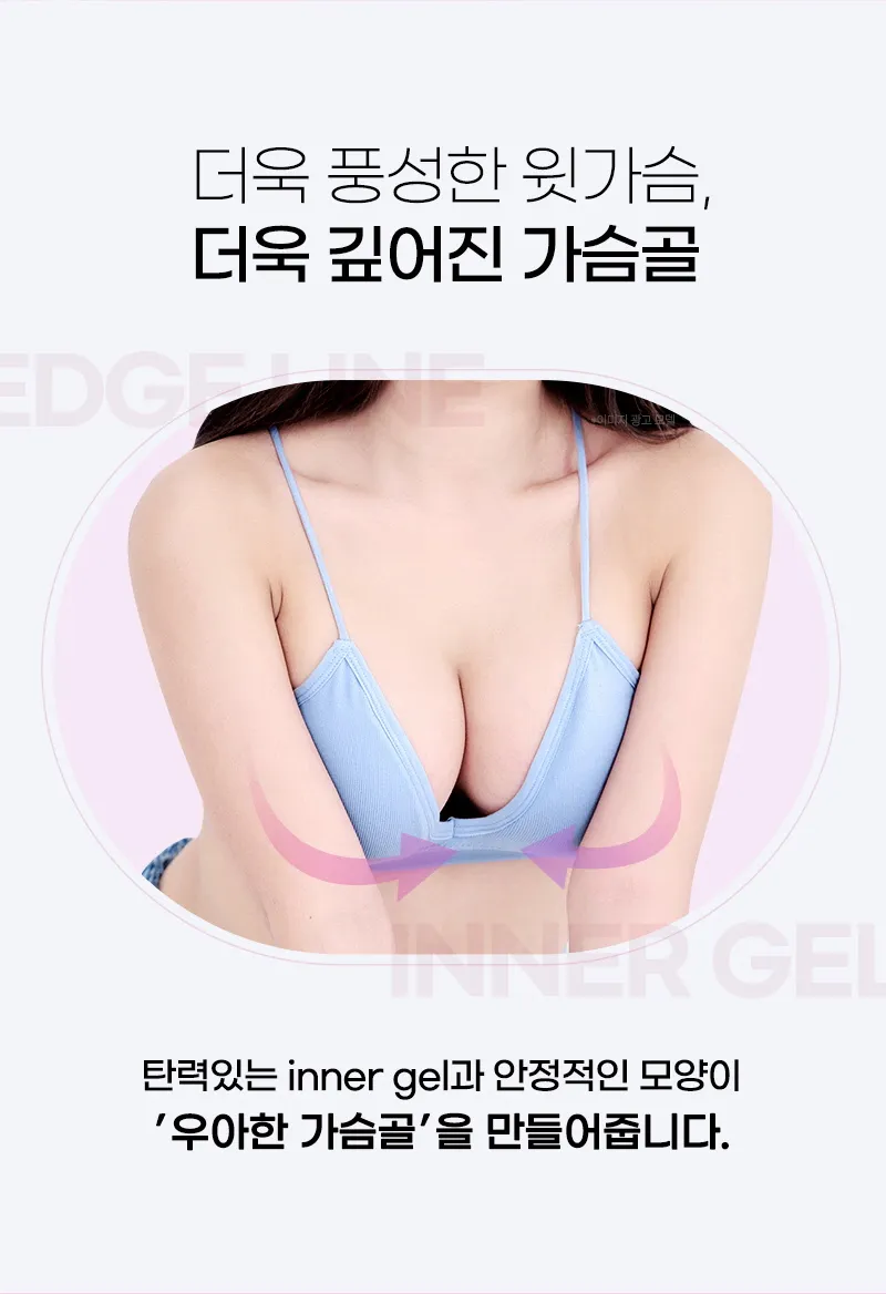 뷰성형외과 ❤️뷰❤️멘토 부스트 이벤트, 시술 상세 이미지