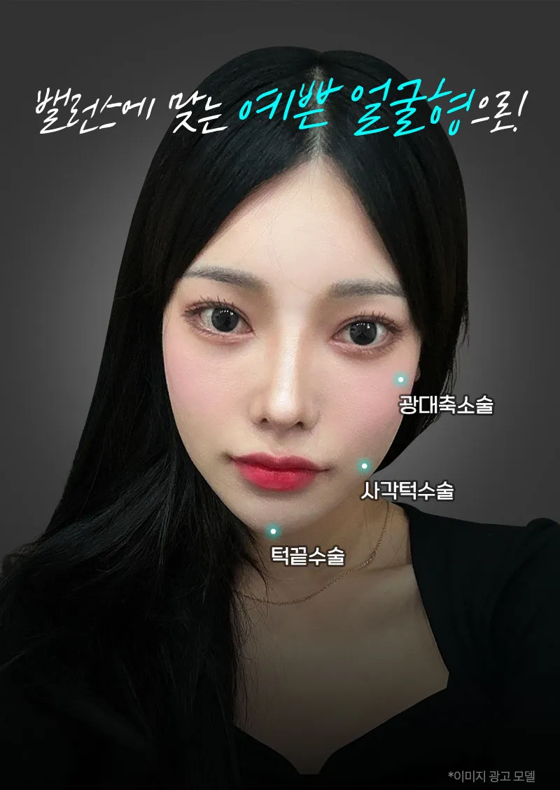뷰성형외과 ❤️뷰❤️안면윤곽 이벤트, 시술 상세 이미지
