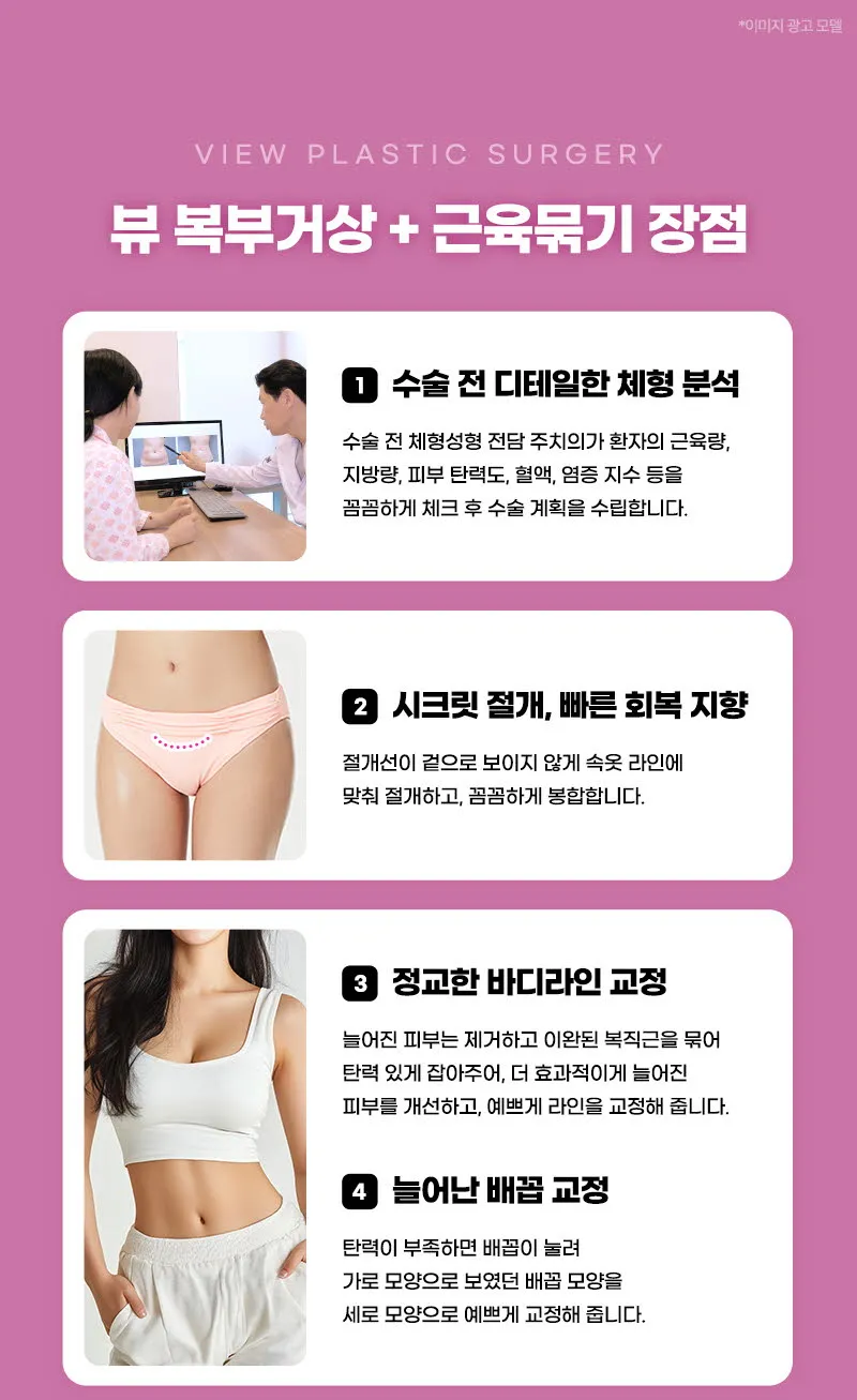 뷰성형외과 ❤뷰❤복부거상술 이벤트, 시술 상세 이미지
