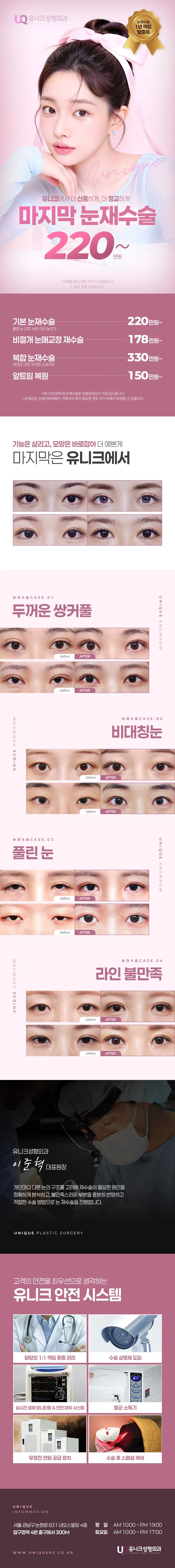 유니크성형외과의원 ♣ 마지막 눈재수술 ♣ 이벤트, 시술 상세 이미지
