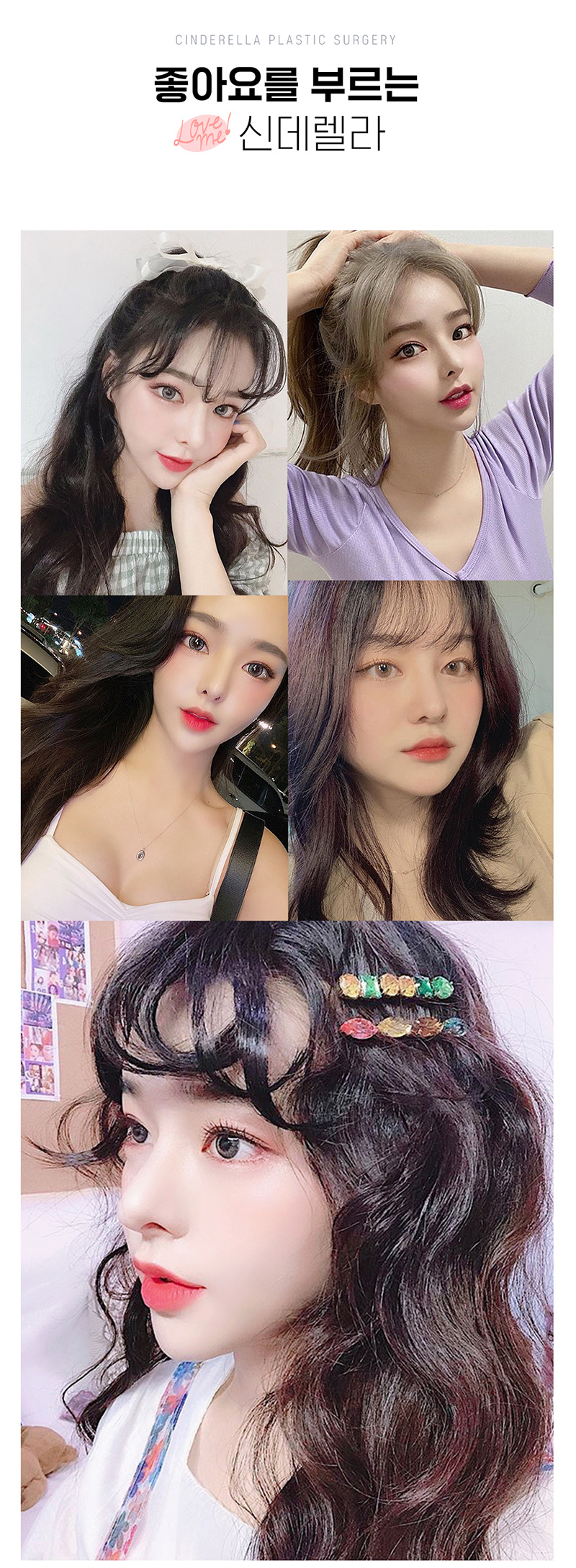 신데렐라성형외과의원 신데렐라 볼륨하안검🧡 이벤트, 시술 상세 이미지