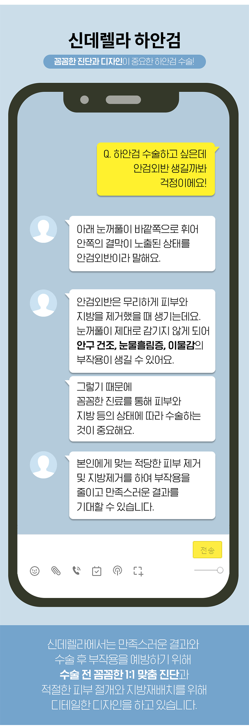 신데렐라성형외과의원 신데렐라 볼륨하안검🧡 이벤트, 시술 상세 이미지