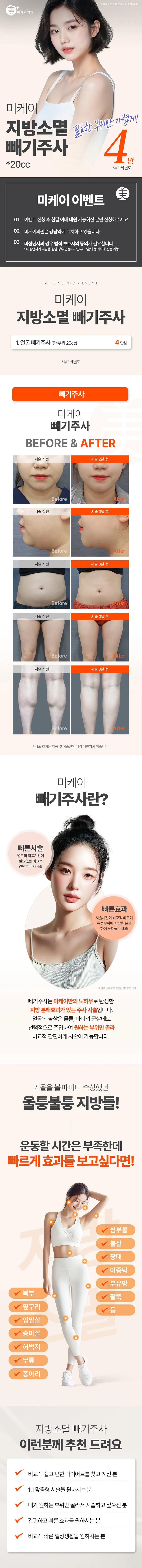 미케이 지방소멸 빼기주사_얼굴