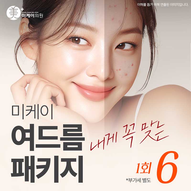 미케이 여드름 패키지_피부관리, 압출 이벤트 썸네일 이미지