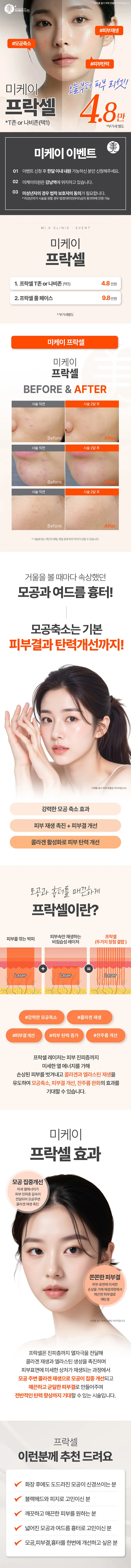 미케이의원 강남 미케이 모공&여드름 흉터 개선_프락셀 이벤트, 시술 상세 이미지