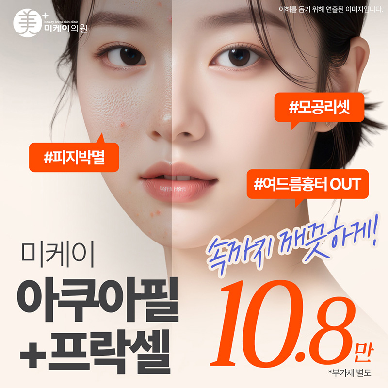 미케이 모공클리어_아쿠아필+프락셀 이벤트 썸네일 이미지