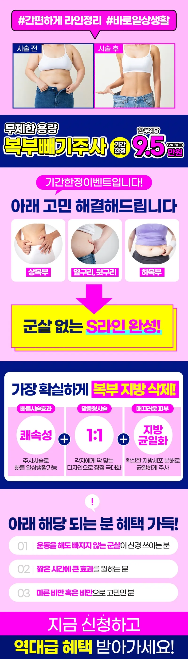 미케이의원 강남 미케이_용량 무제한💉복부 빼기주사 이벤트, 시술 상세 이미지