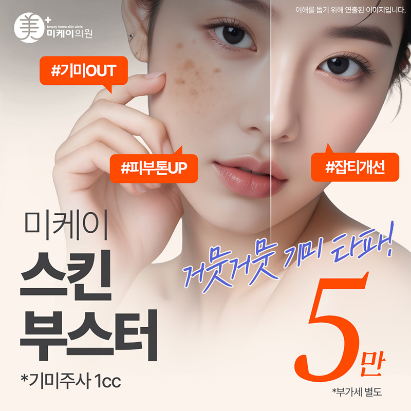 미케이 기미&잡티 개선 스킨부스터_기미주사 1cc 이벤트 썸네일 이미지