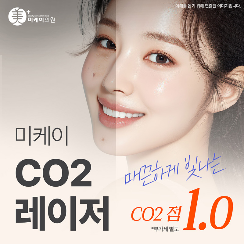  미케이 CO2 레이저_점, 사마귀 이벤트 썸네일 이미지