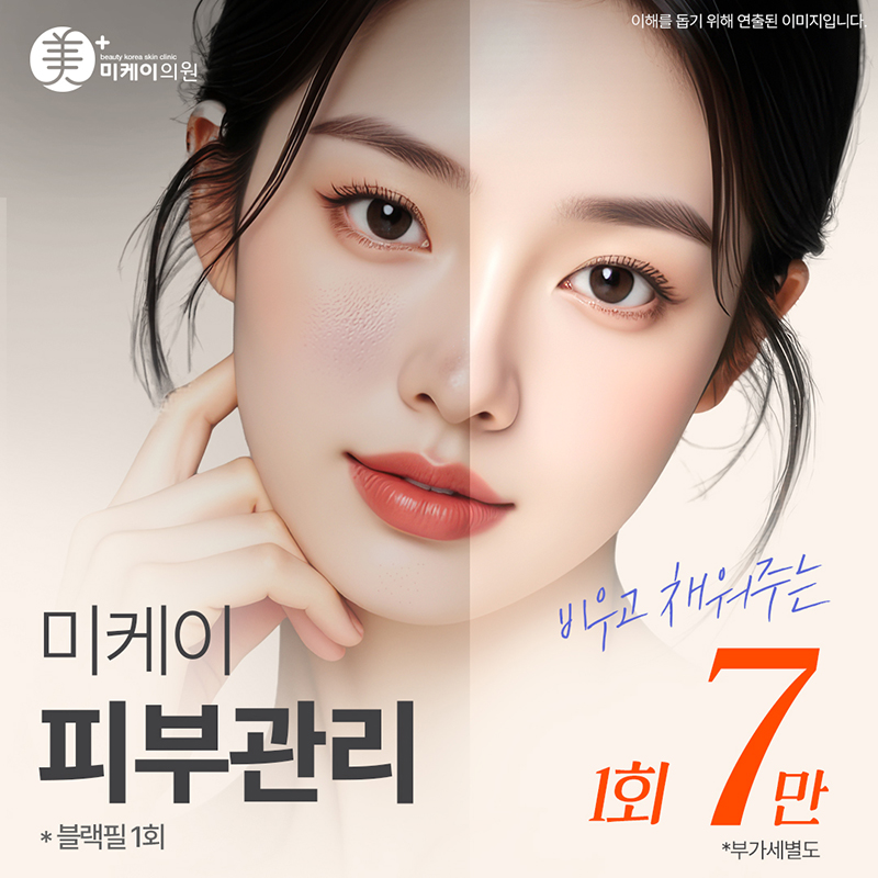 미케이  피부관리 _블랙필, 물톡스 이벤트 썸네일 이미지