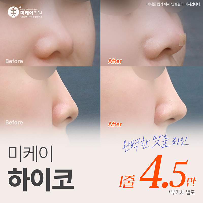 미케이 자신감있는 콧대 민트실_하이코 이벤트 썸네일 이미지