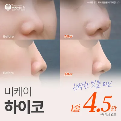 미케이 자신감있는 콧대 민트실_하이코 이벤트 썸네일 이미지