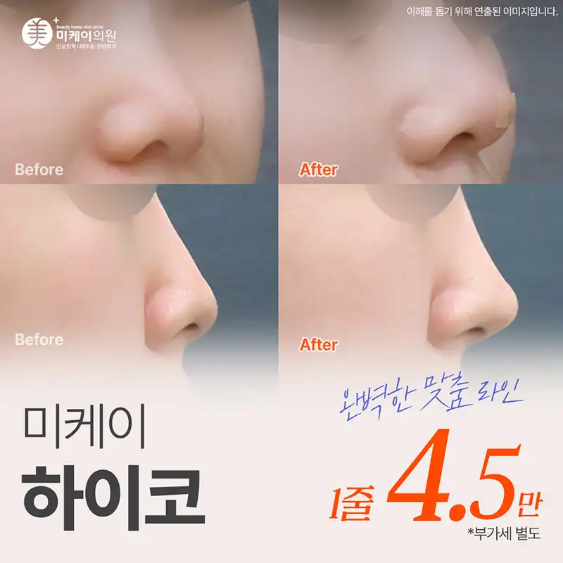 미케이 자신감있는 콧대 민트실_하이코
