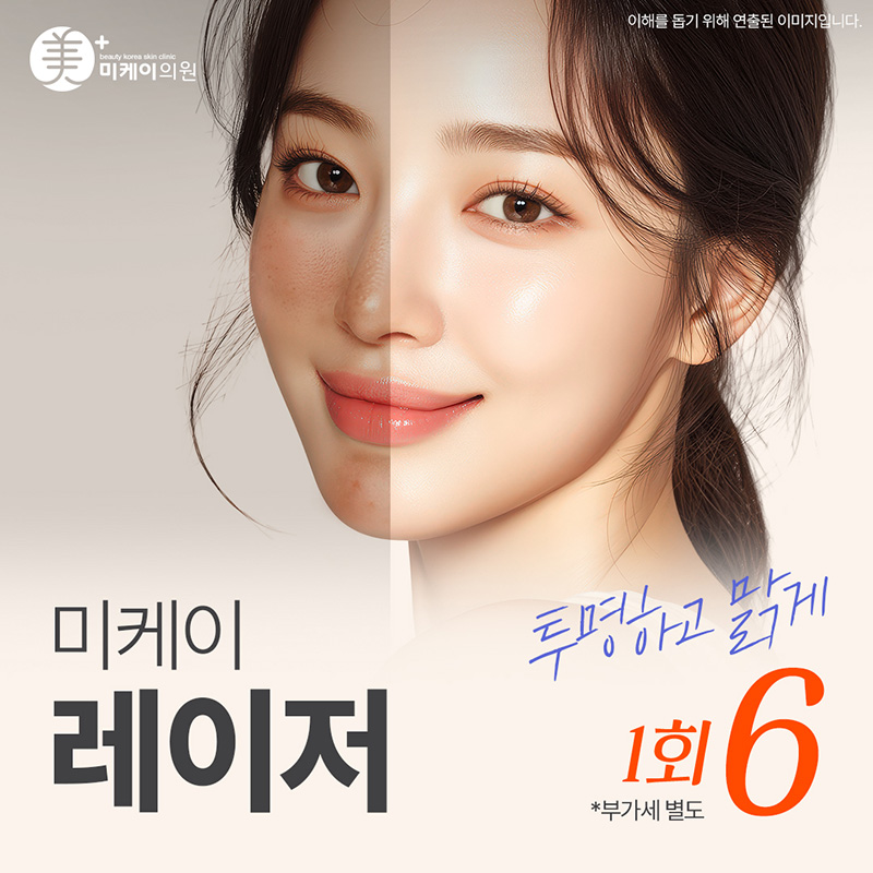 미케이 자국 지우개_레이저토닝 이벤트 썸네일 이미지