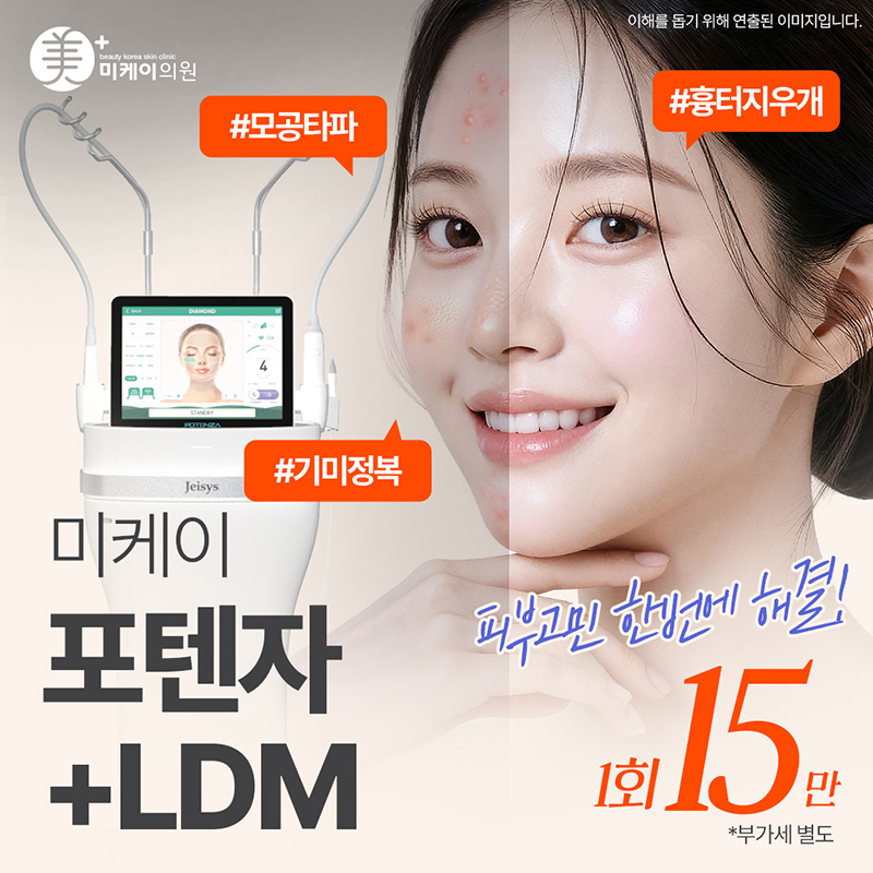 미케이 여드름 흉터 개선_포텐자 이벤트 썸네일 이미지