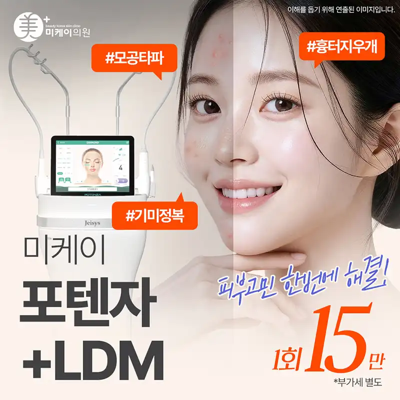 미케이 여드름 흉터 개선_포텐자