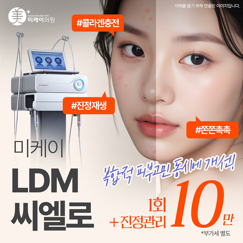 미케이 피부재생, 여드름흉터_LDM 이벤트 썸네일 이미지
