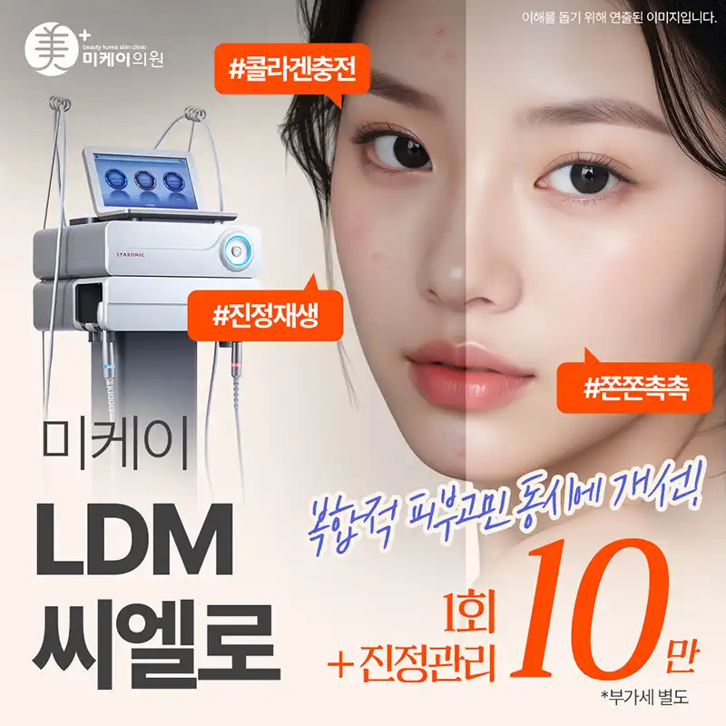 미케이 피부재생, 여드름흉터_LDM