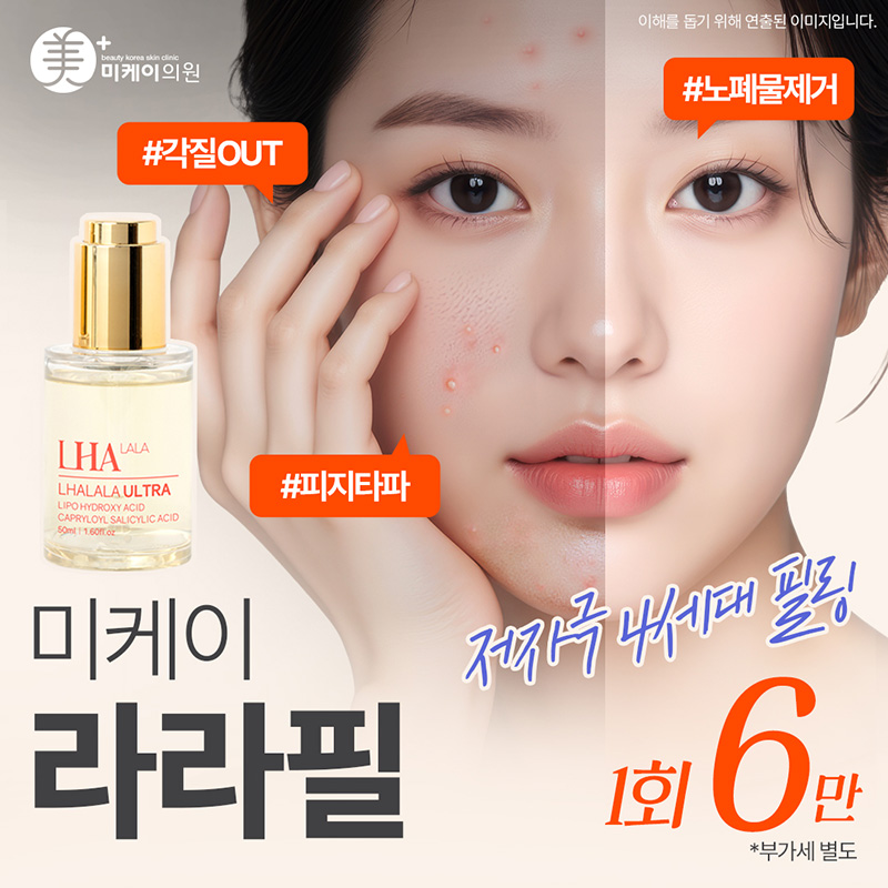 미케이 각질제거 스킨케어_라라필 이벤트 썸네일 이미지