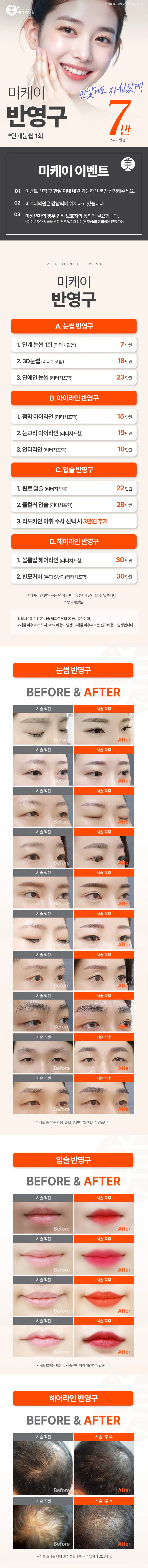 미케이의원 강남 미케이 반영구_눈썹, 입술, 아이라인 이벤트, 시술 상세 이미지