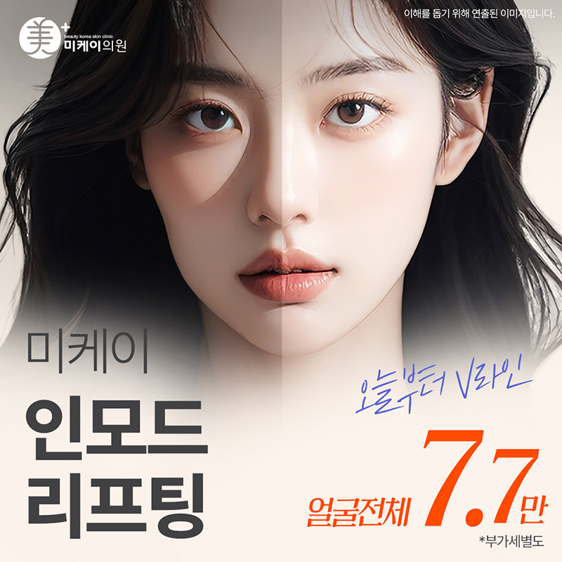 미케이 인모드 포마_얼굴탄력,브이라인 이벤트 썸네일 이미지