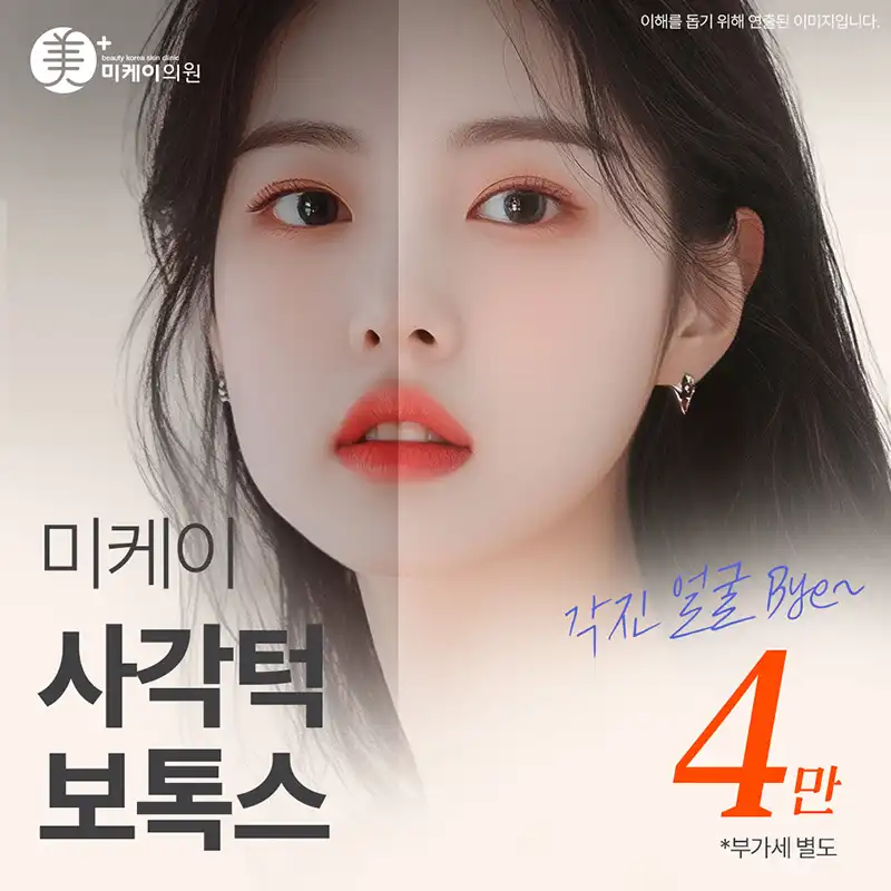 MiK 사각턱 보톡스