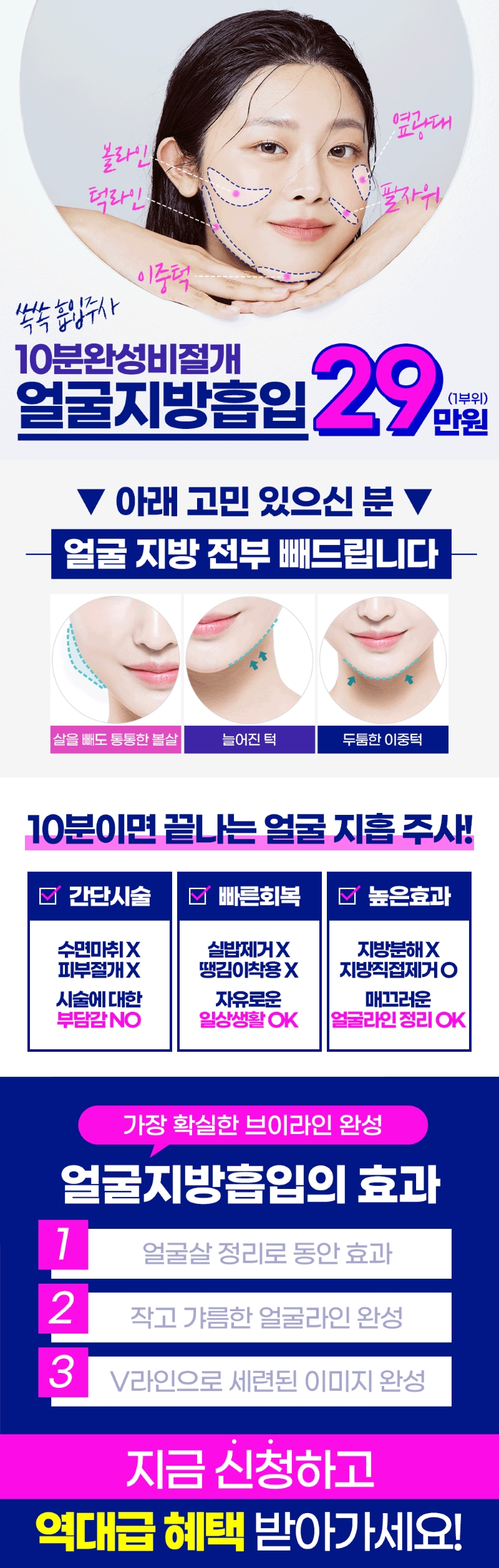 티오피성형외과 10분완성🧡쏙쏙흡입주사💉 이벤트, 시술 상세 이미지