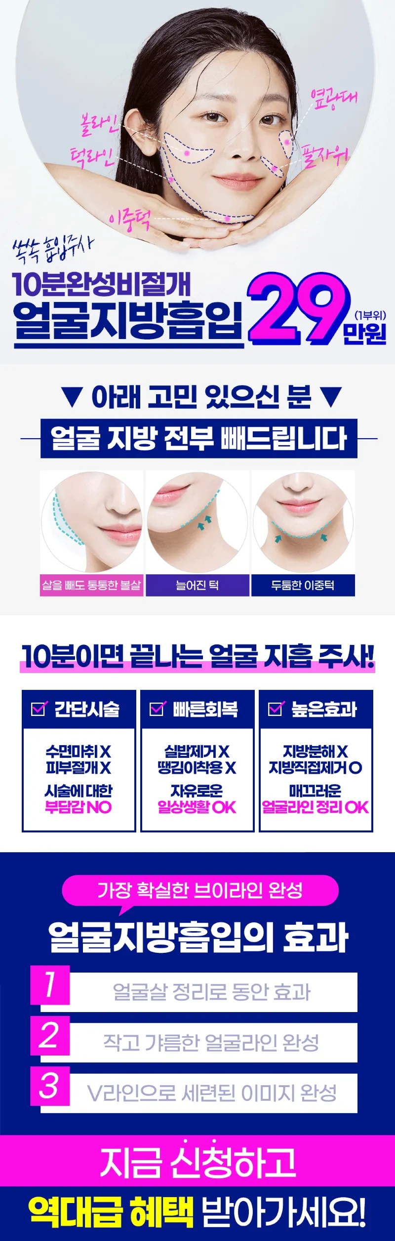 티오피성형외과 10분완성🧡쏙쏙흡입주사💉 이벤트, 시술 상세 이미지