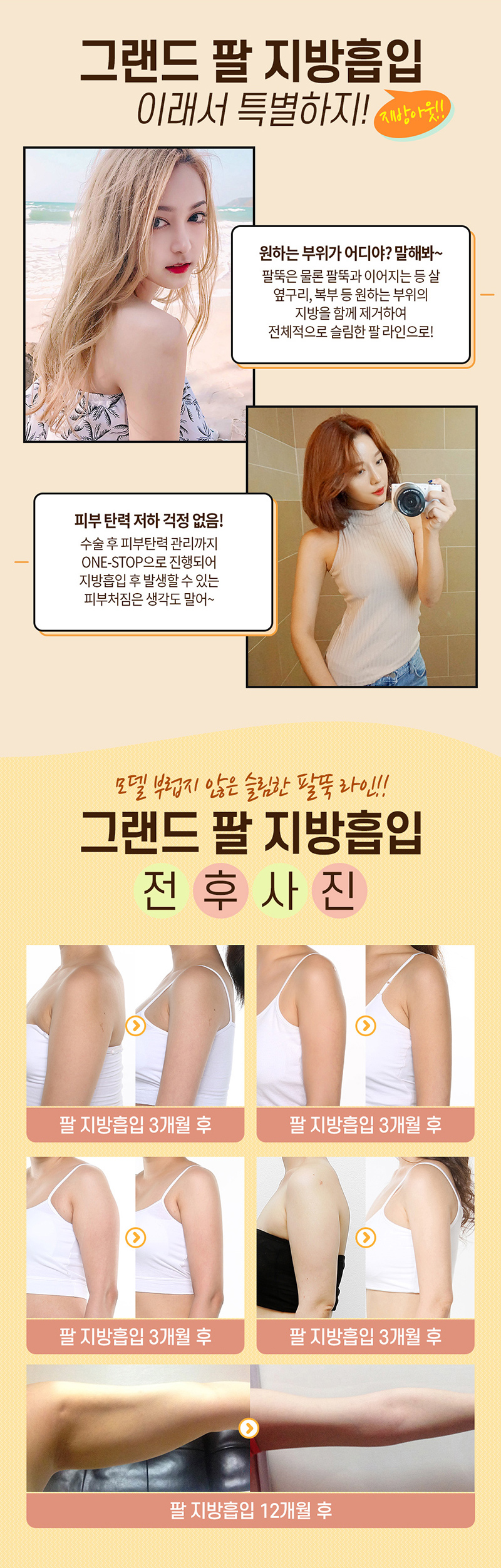 그랜드성형외과 팔 전체 지방흡입 이벤트, 시술 상세 이미지