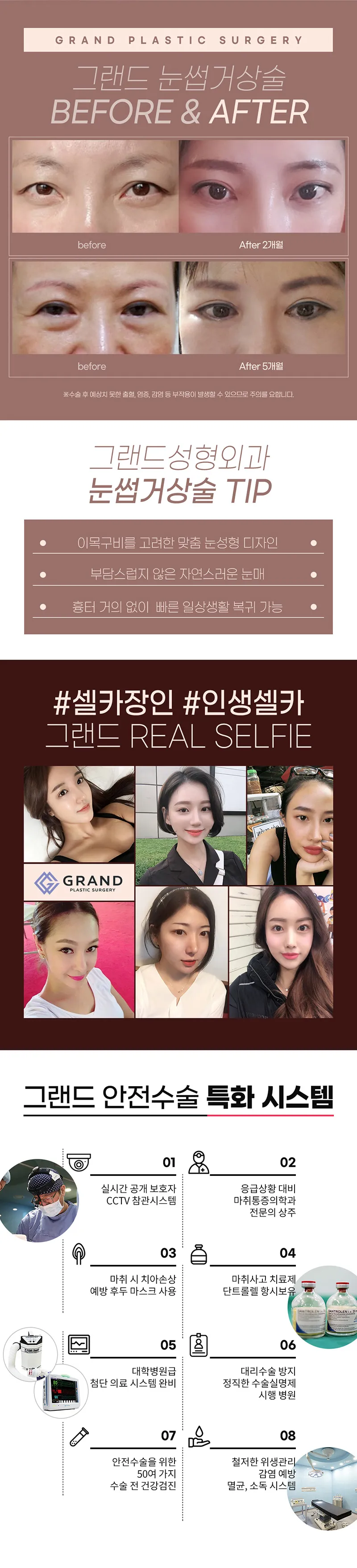 그랜드성형외과 눈썹거상술 처진 눈꺼풀 개선 이벤트, 시술 상세 이미지