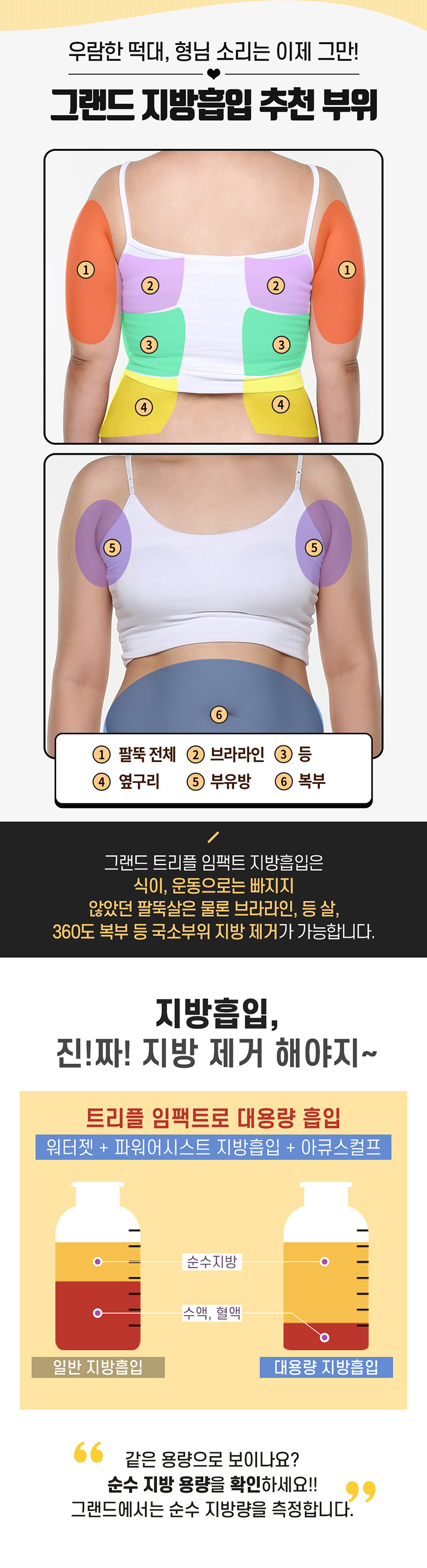 그랜드성형외과 팔 전체 지방흡입 이벤트, 시술 상세 이미지