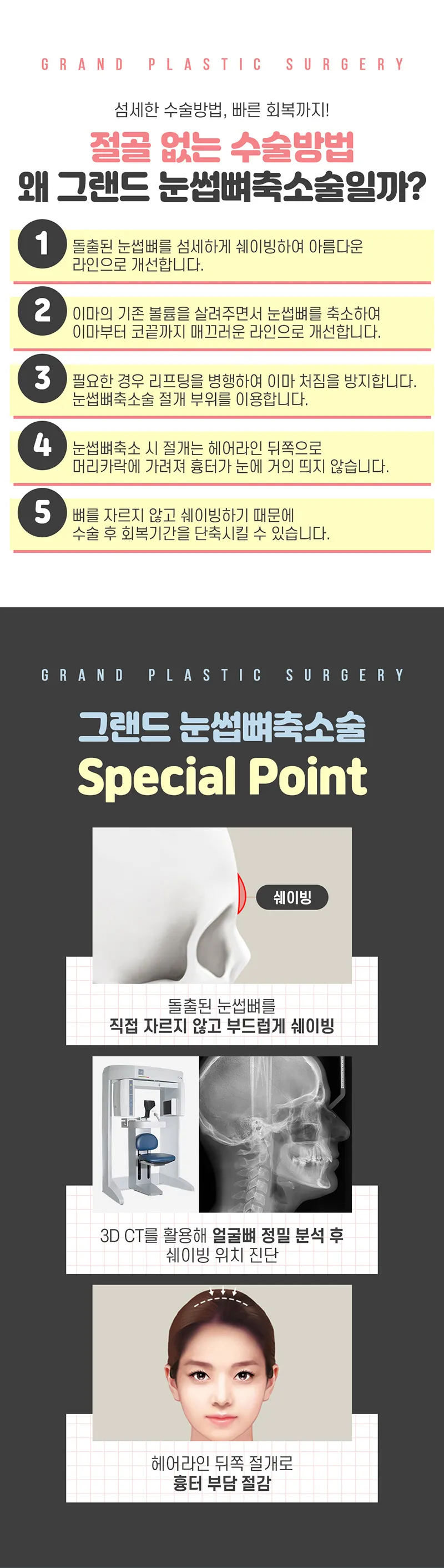 그랜드성형외과 부드러운 이마라인 눈썹뼈축소 이벤트, 시술 상세 이미지