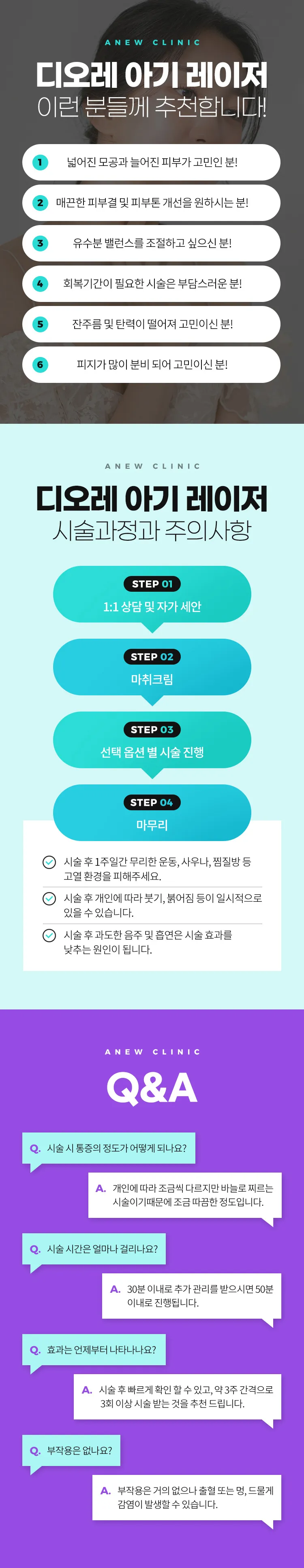 어뉴의원 디오레 아기레이저 이벤트, 시술 상세 이미지