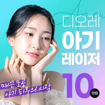 디오레 아기레이저 이벤트 썸네일 이미지