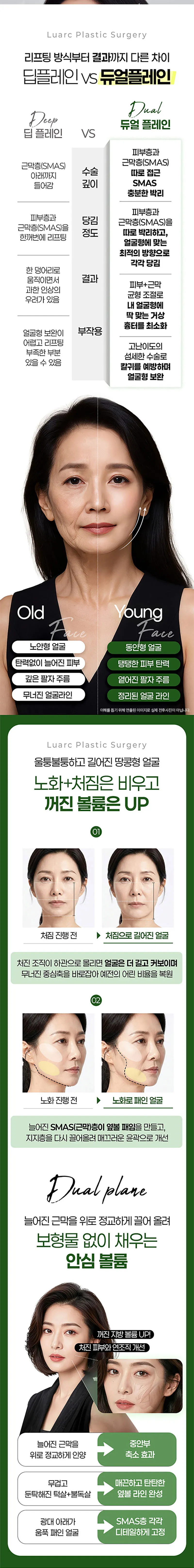 루아크성형외과 루아크 SMAS 듀얼플레인 풀안면거상 이벤트, 시술 상세 이미지