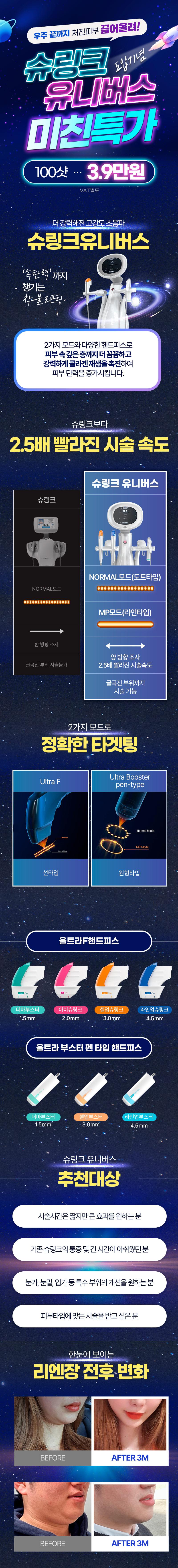 리엔장의원 잠실점 슈링크유니버스 미친특가 이벤트, 시술 상세 이미지