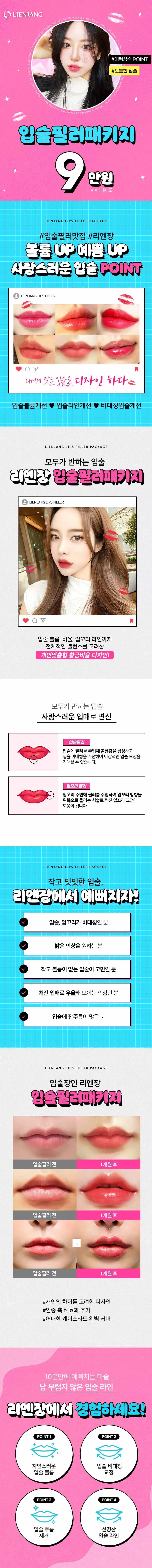 리엔장의원 잠실점 잠실 입술필러패키지 이벤트, 시술 상세 이미지