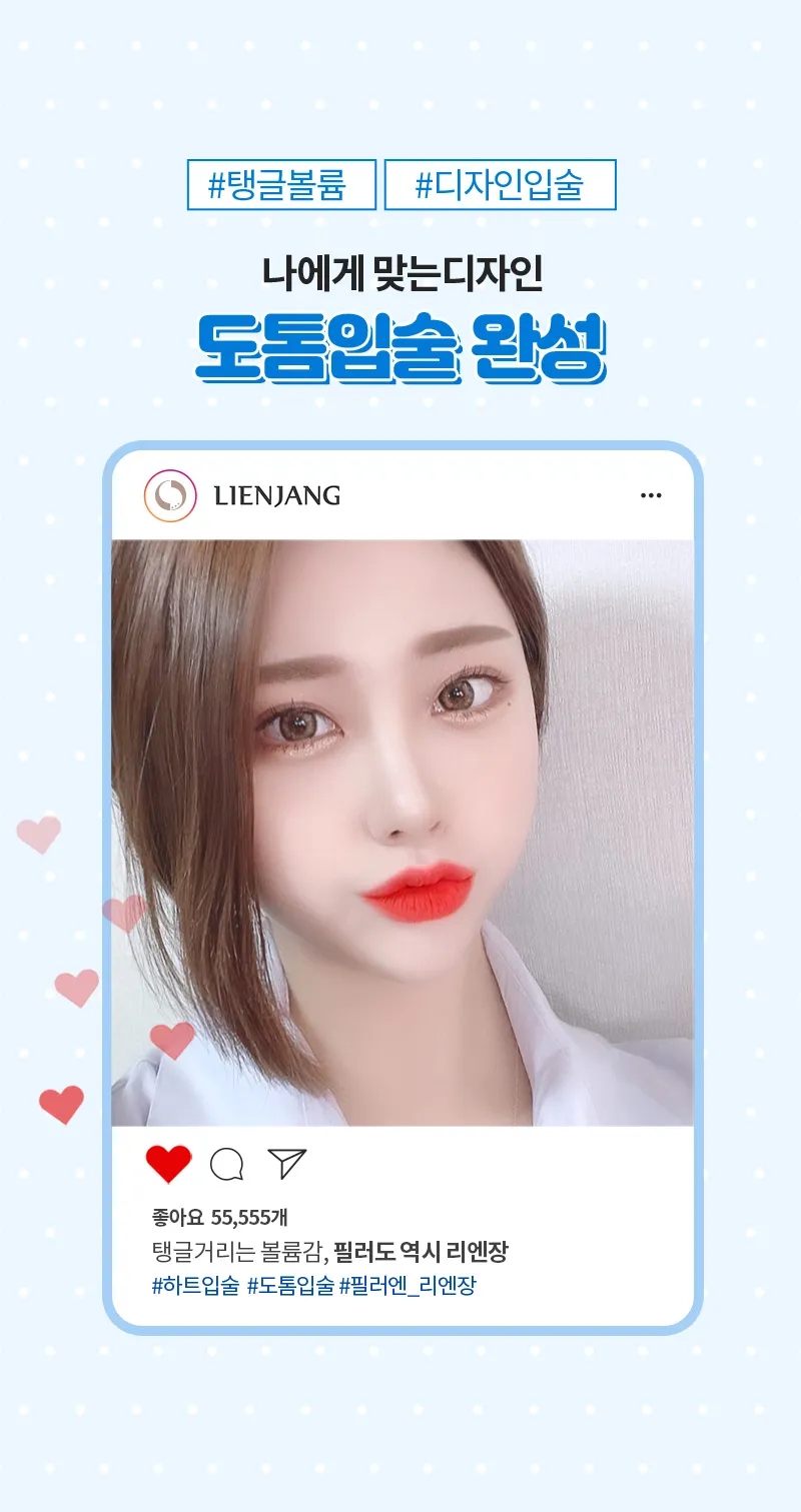 리엔장의원 하남미사 하남 앵두라인 입술필러 이벤트, 시술 상세 이미지