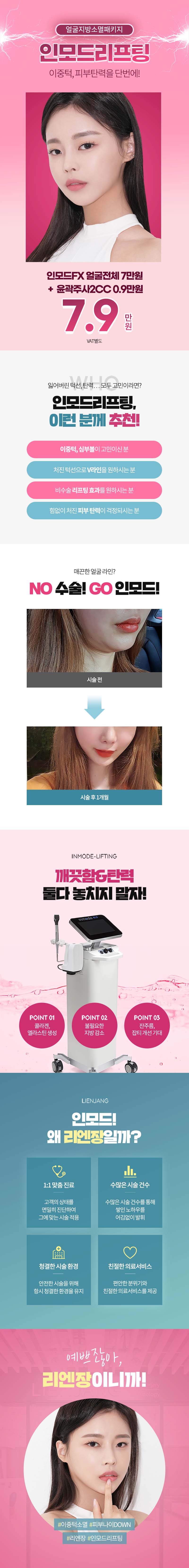 리엔장성형외과 인모드FX+윤곽주사 이벤트, 시술 상세 이미지