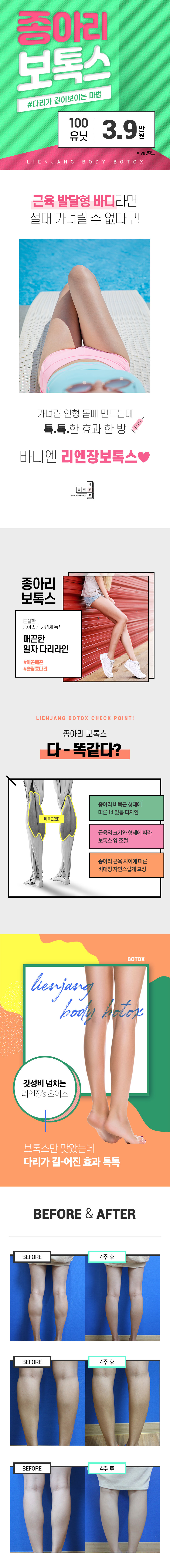 리엔장성형외과 종아리보톡스 이벤트, 시술 상세 이미지