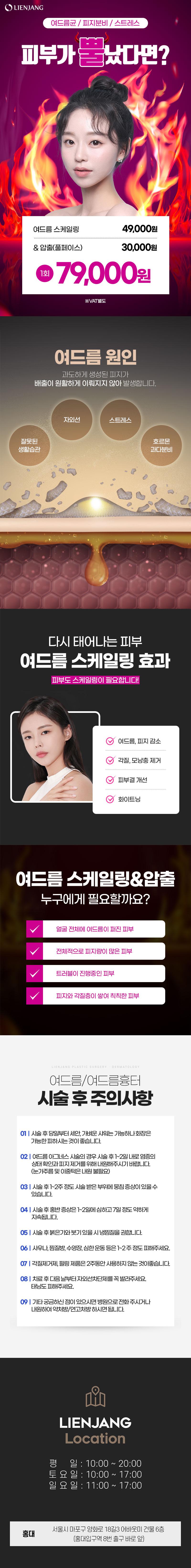 리엔장의원 홍대점 여드름 스케일링&압출 이벤트, 시술 상세 이미지