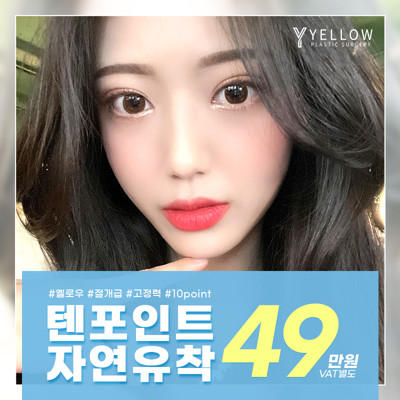 💛옐로우 텐포인트 자연유착💛 이벤트 썸네일 이미지