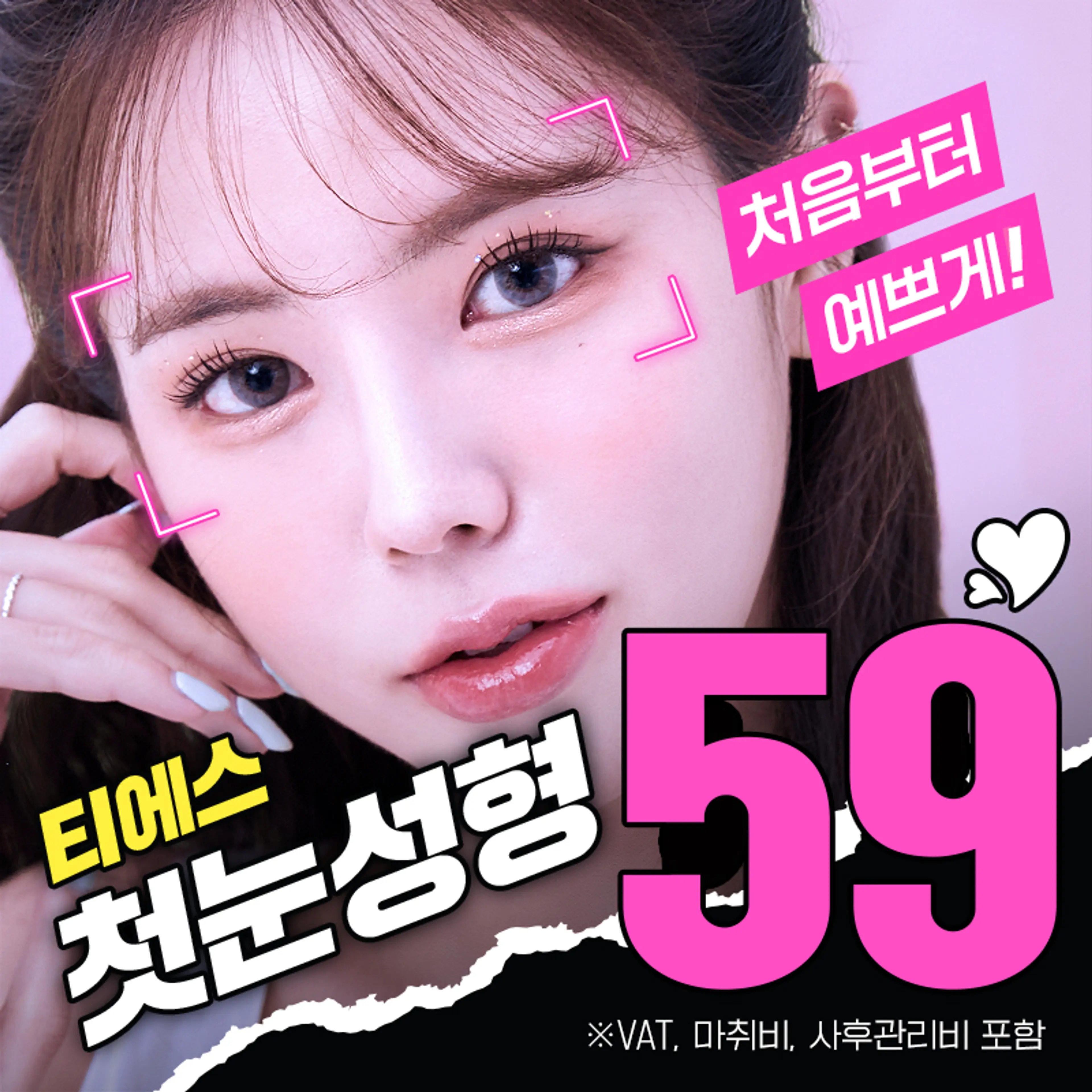 티에스 첫눈성형 모음