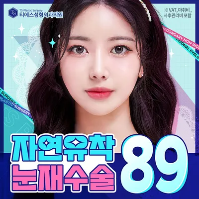 티에스 자연유착 눈재수술 이벤트 썸네일 이미지
