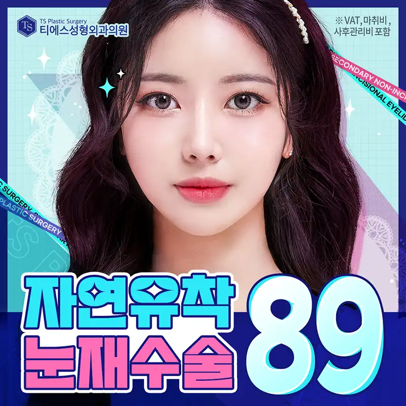 티에스 자연유착 눈재수술